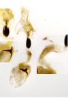 Coleophora binderella