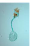 Metendothenia atropunctana
