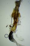 Coleophora lutipennella
