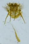 Cnephasia