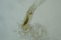 Coleophora glaucicolella