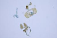 Coleophora anatipennella