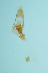 Crassa tinctella