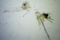 Scrobipalpa ocellatella