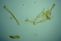 Alucita cymatodactyla