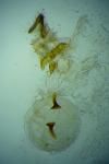 Gypsonoma aceriana