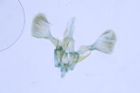 Parornix finitimella
