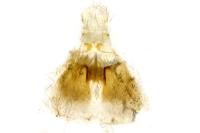 Plutella xylostella