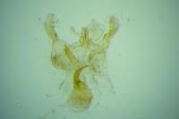 Infurcitinea albicomella