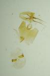 Epinotia maculana