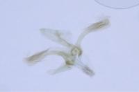 Cameraria ohridella