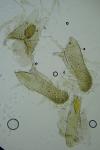 Elachista subocellea