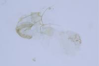 Phalonidia contractana