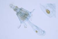 Phaulernis dentella