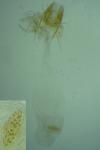 Agonopterix xeranthemella