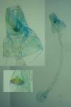 Agonopterix