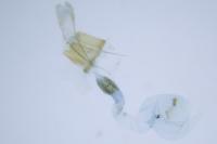 Homaloxestis briantiella