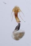 Coleophora lutipennella
