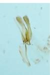 Phyllonorycter mespilella
