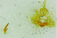 Archips xylosteana