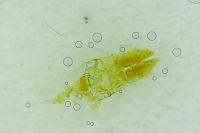 Acleris forsskaleana