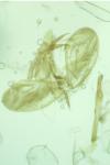 Ypsolopha divisella