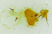 Cydia splendana