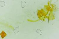 Depressaria