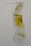 Mompha subbistrigella