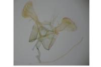 Parornix atripalpella