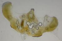 Epinotia immundana