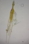Nematopogon