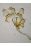 Coleophora adspersella