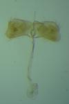 Tinagma ocnerostomella