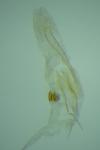 Coleophora trigeminella