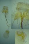 Coleophora zelleriella