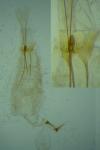 Stenolechia gemmella