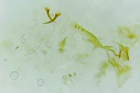 Caloptilia alchimiella