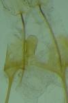 Anacampsis timidella