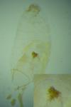 Stigmella atricapitella