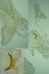 Argyresthia arceuthina