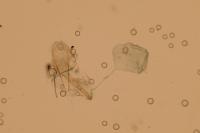 Acrolepiopsis assectella