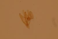 Mompha epilobiella