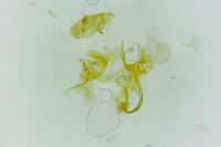 Aproaerema anthyllidella
