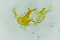 Infurcitinea albicomella
