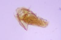 Stigmella speciosa