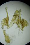 Scrobipalpa acuminatella