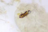 Depressaria albipunctella
