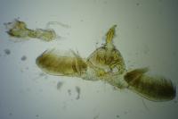 Gillmeria pallidactyla