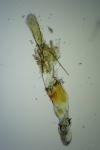 Mompha subbistrigella